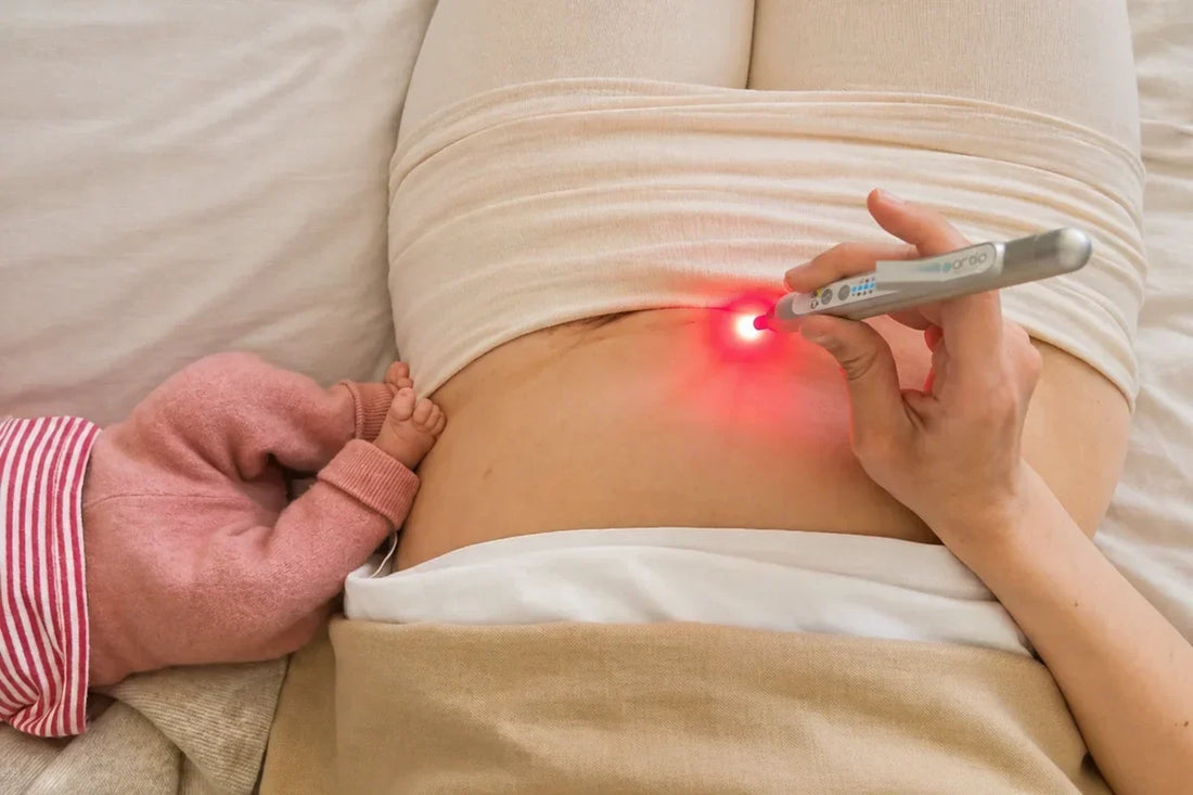 Low Level Lasertherapie: Therapielaser im Einsatz an der Kaiserschnittnarbe
